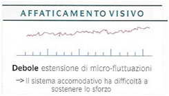 Affaticamento visivo